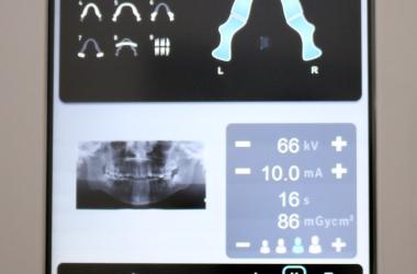 Porqué son importantes las radiografias dentales